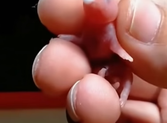 D2004012 They need life… not excuses. (Part 2)